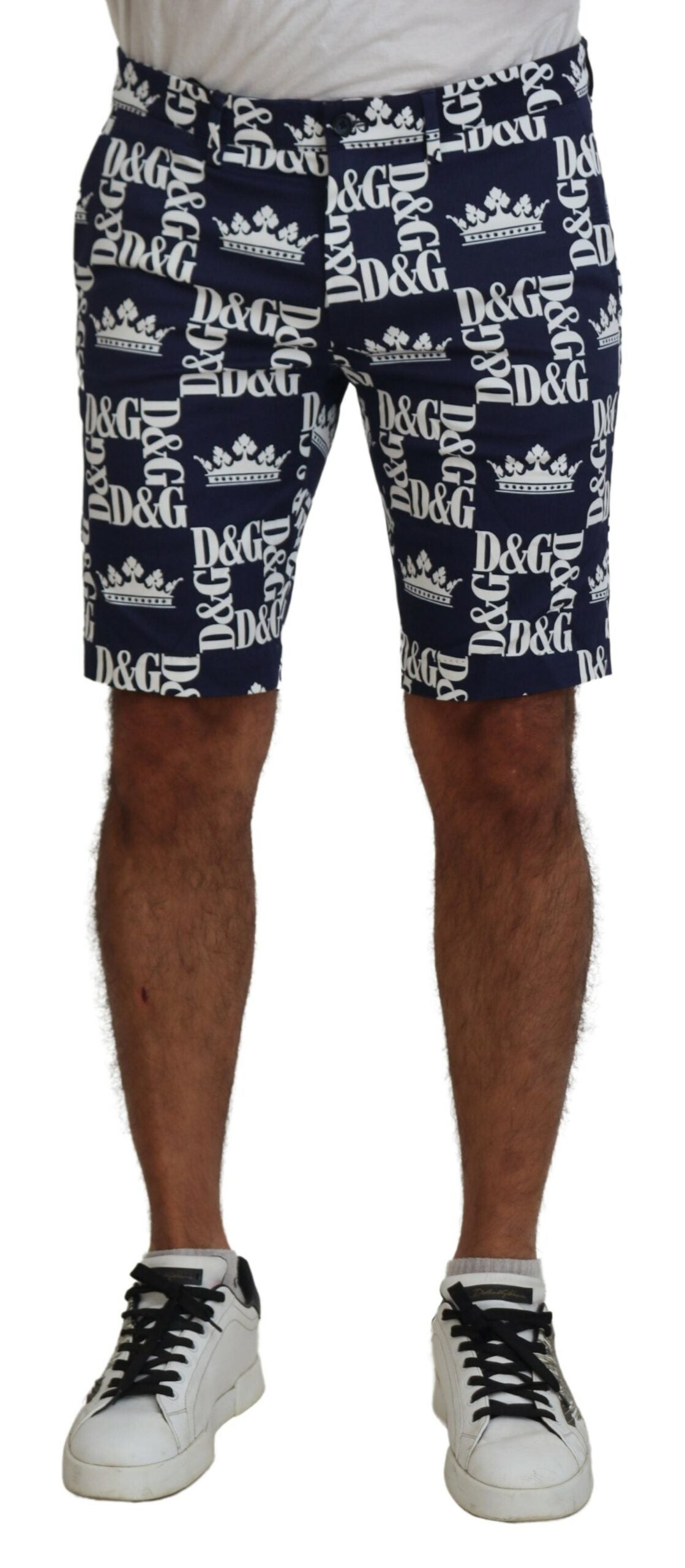 Man wearing blue shorts with white logo