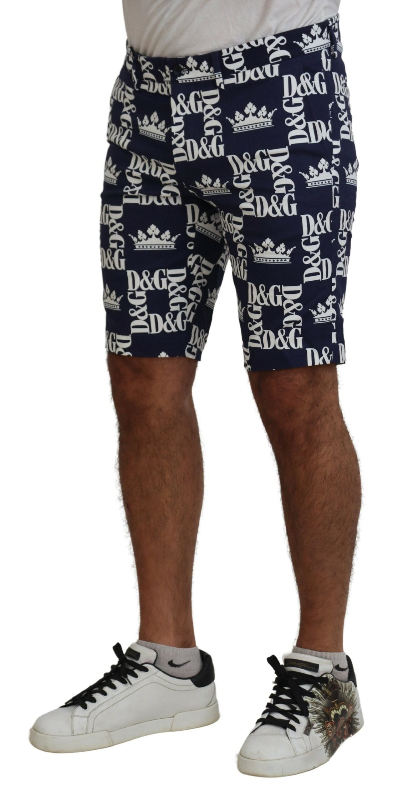 Man wearing shorts and sneakers
