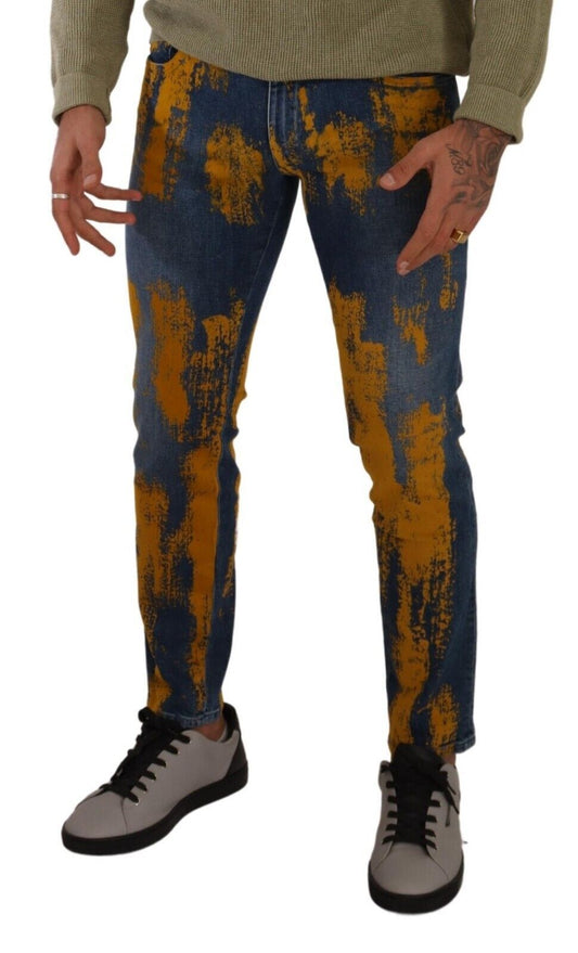 Man wearing distressed jeans