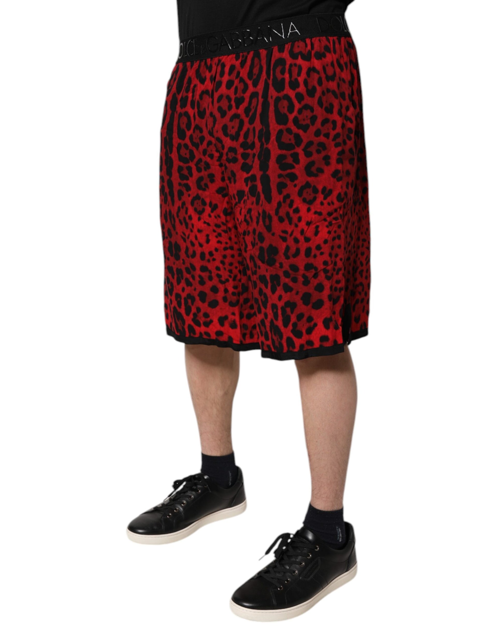 Man wearing red shorts with leopard print pattern