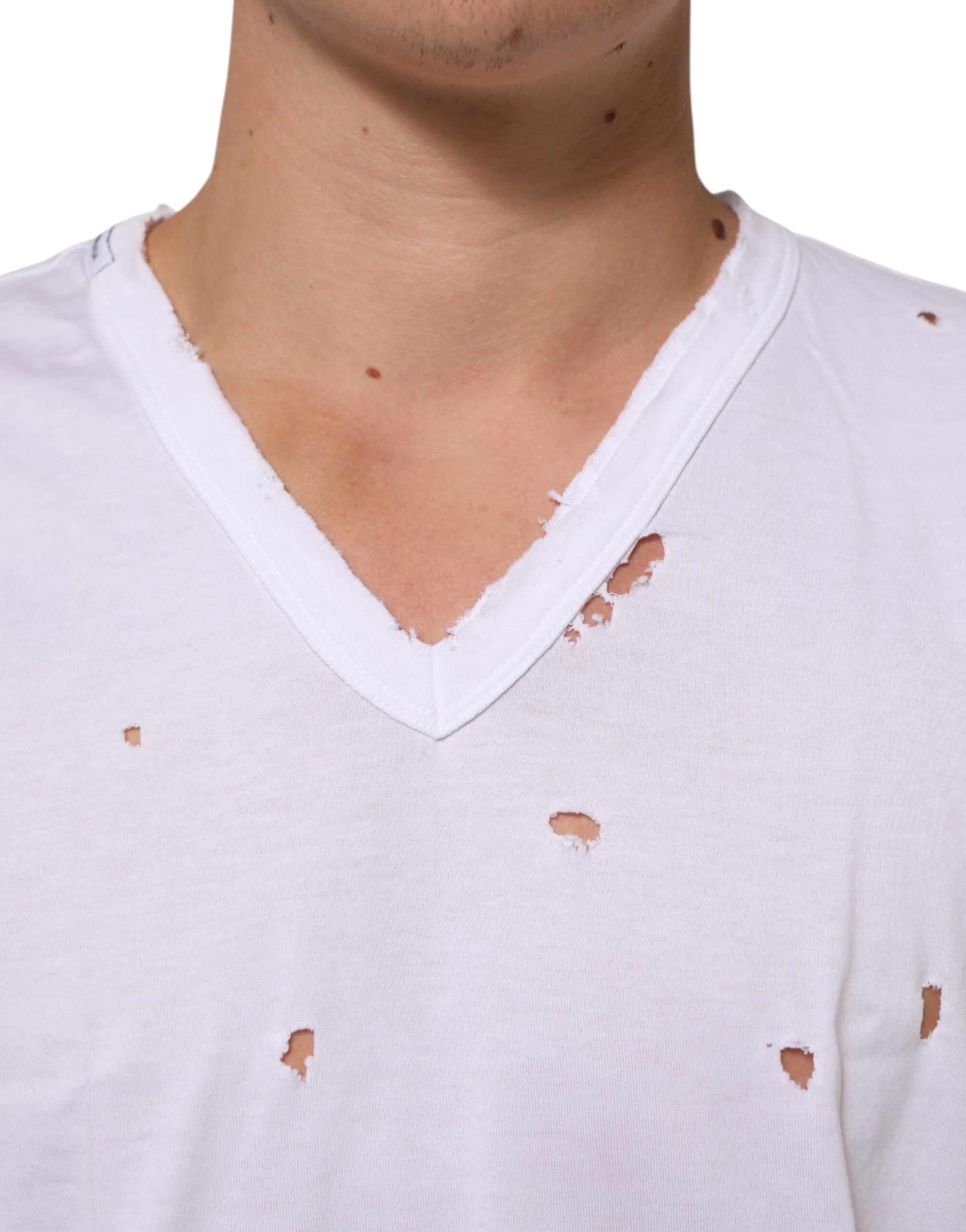Man wearing white shirt with peeling fabric