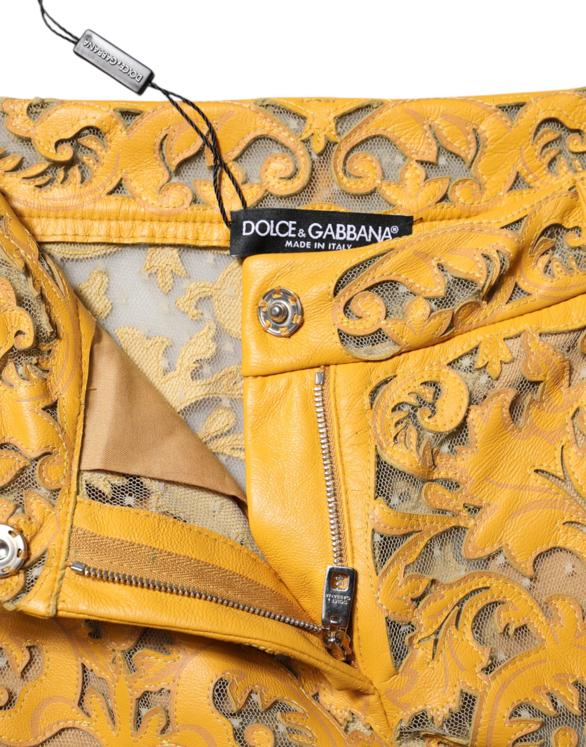 Yellow jacket with zipper detailing