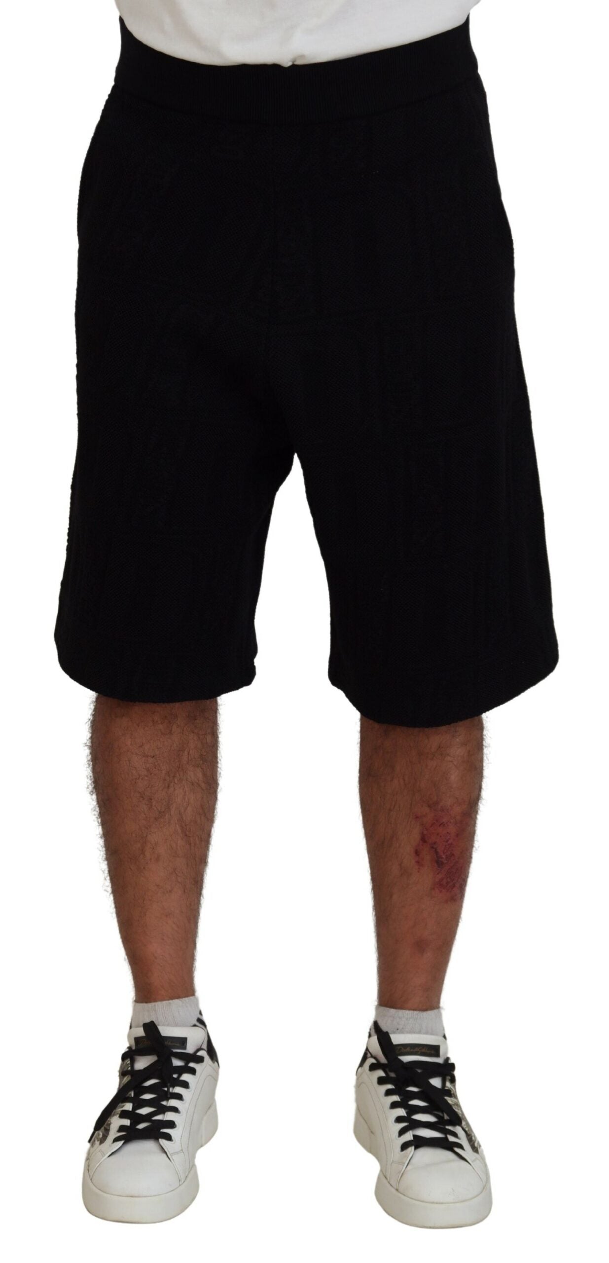 Man wearing black shorts and white sneakers